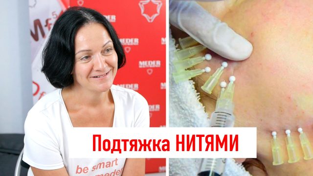 Подтяжка лица нитями (тредлифтинг или нитевой лифтинг) – это популярная процедура, которую часто называют заменой пластической хирургии. Могут ли нити вернуть молодость на самом деле и о каких осложнениях специалисты предпочитают умолчать?